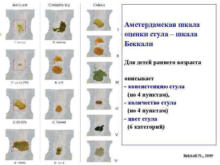 Амстердамская шкала оценки стула – шкала Беккали Для детей раннего возраста описывает - консистенцию Амстердамская шкала оценки стула – шкала Беккали Для детей раннего возраста описывает - консистенцию