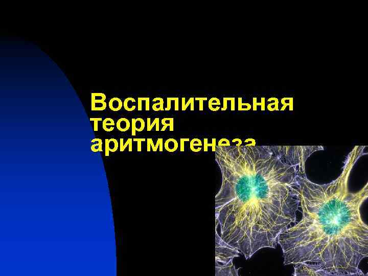 Воспалительная теория аритмогенеза 