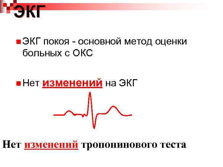  ЭКГ  n ЭКГпокоя - основной метод оценки  больных с ОКС n