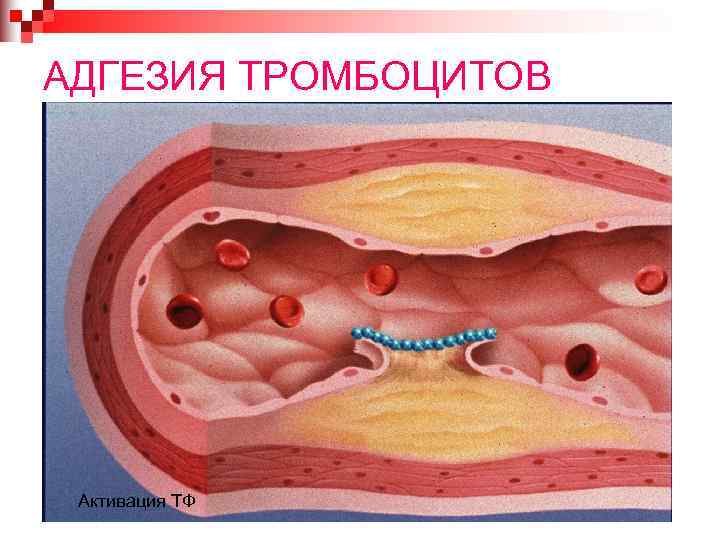 АДГЕЗИЯ ТРОМБОЦИТОВ Активация ТФ 