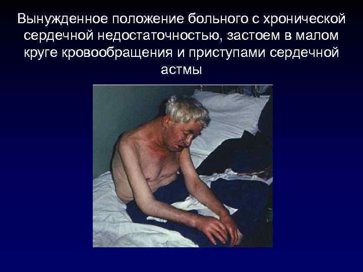Вынужденное положение больного с хронической  сердечной недостаточностью, застоем в малом  круге кровообращения