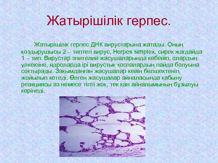   Жатырішілік герпес ДНК вирустарына жатады. Оның қоздырушысы 2 – типтегі вирус, Herpes