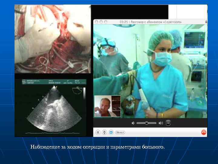 Наблюдение за ходом операции и параметрами больного. Наблюдение за ходом операции и параметрами больного.