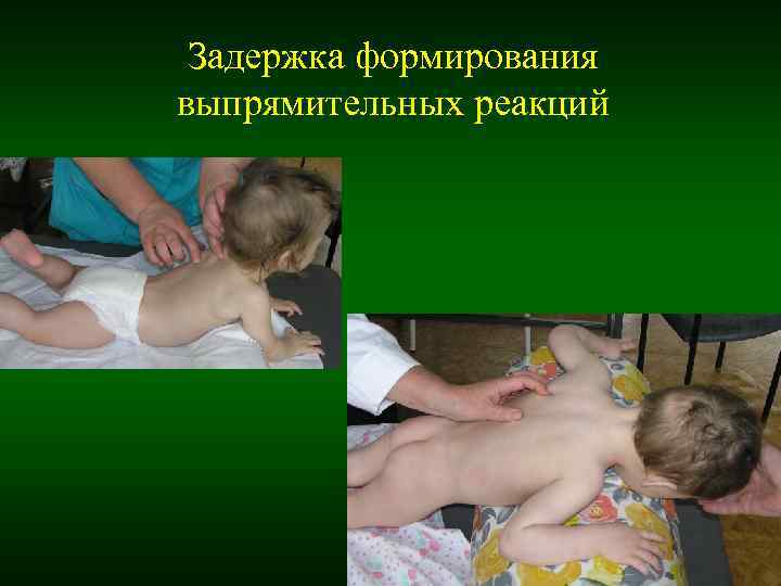 Задержка формирования выпрямительных реакций Задержка формирования выпрямительных реакций