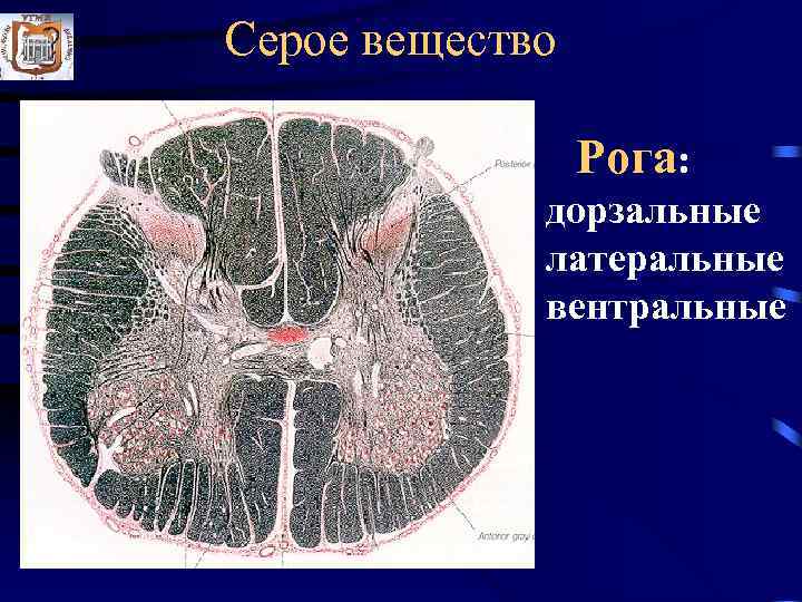 Серое вещество    Рога:    дорзальные   латеральные 