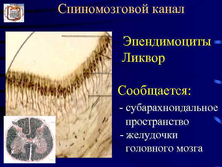 Спиномозговой канал  Эпендимоциты   Ликвор   Сообщается:  - субарахноидальное 