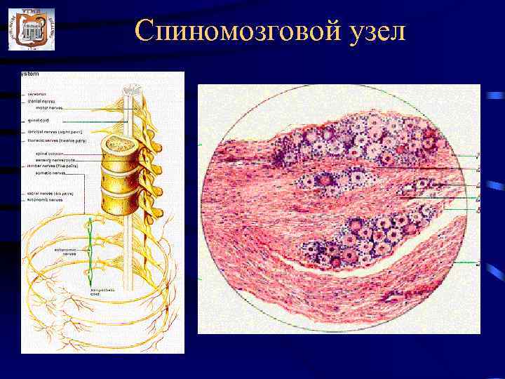 Спиномозговой узел 