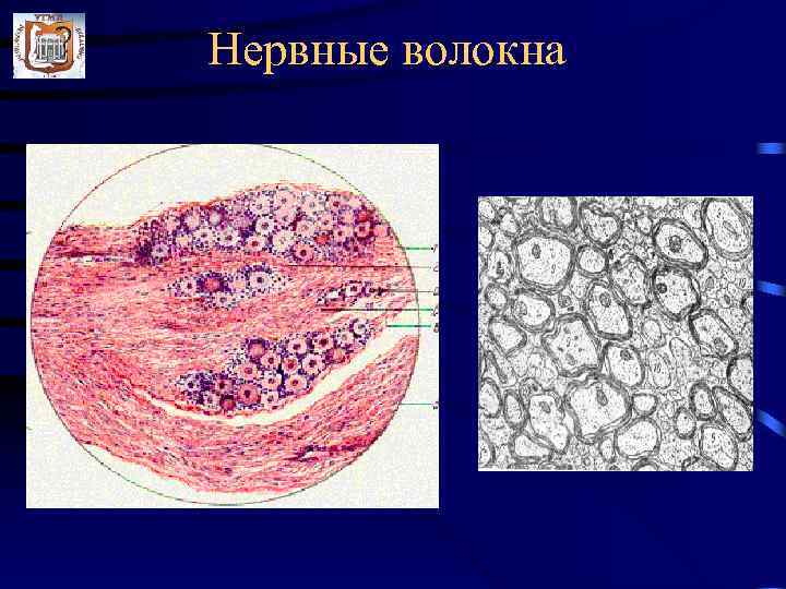 Нервные волокна 