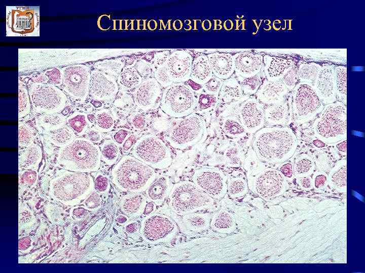 Спиномозговой узел 