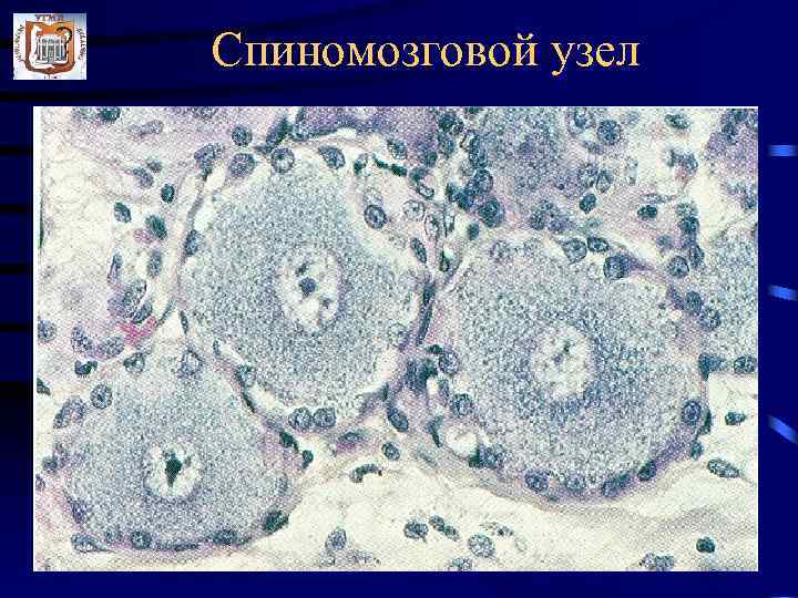 Спиномозговой узел 