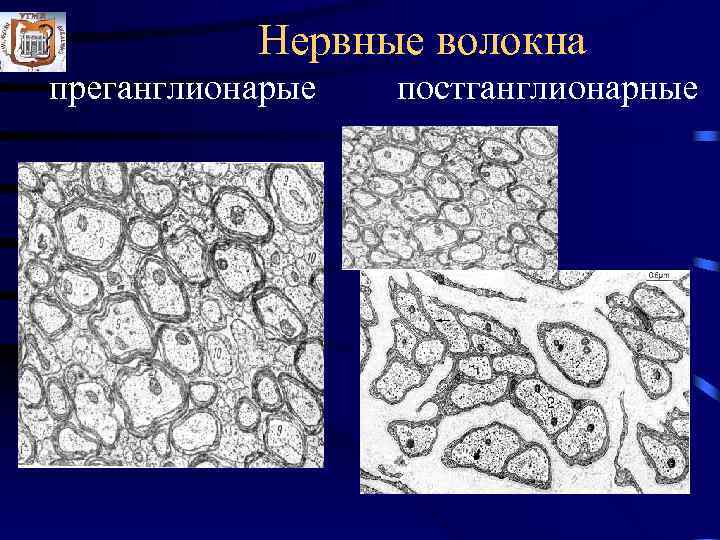   Нервные волокна преганглионарые  постганглионарные 