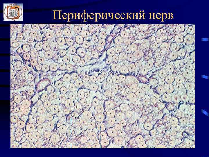 Периферический нерв 