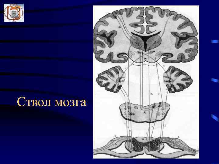 Ствол мозга 
