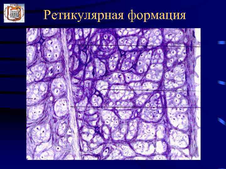 Ретикулярная формация 