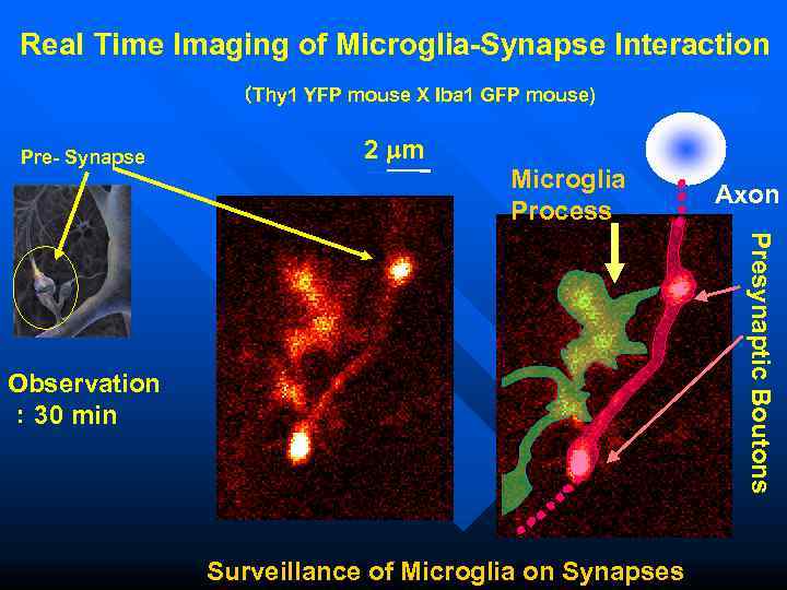 Real Time Imaging of Microglia-Synapse Interaction   （Thy 1 YFP mouse X Iba
