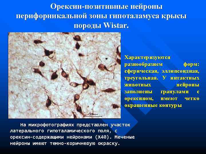    Орексин-позитивные нейроны  перифорникальной зоны гипоталамуса крысы    породы