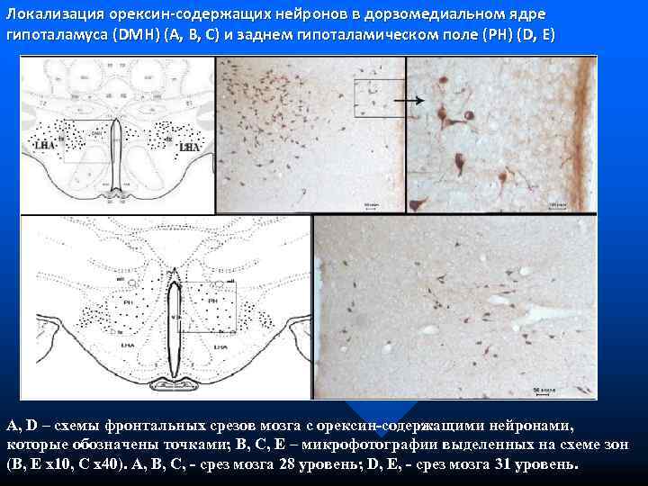 Локализация орексин-содержащих нейронов в дорзомедиальном ядре гипоталамуса (DMH) (A, B, C) и заднем гипоталамическом