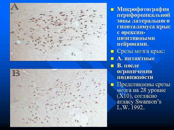 n  Микрофотография перифорникальной зоны латерального гипоталамуса крыс с орексин- позитивными нейронами. n 