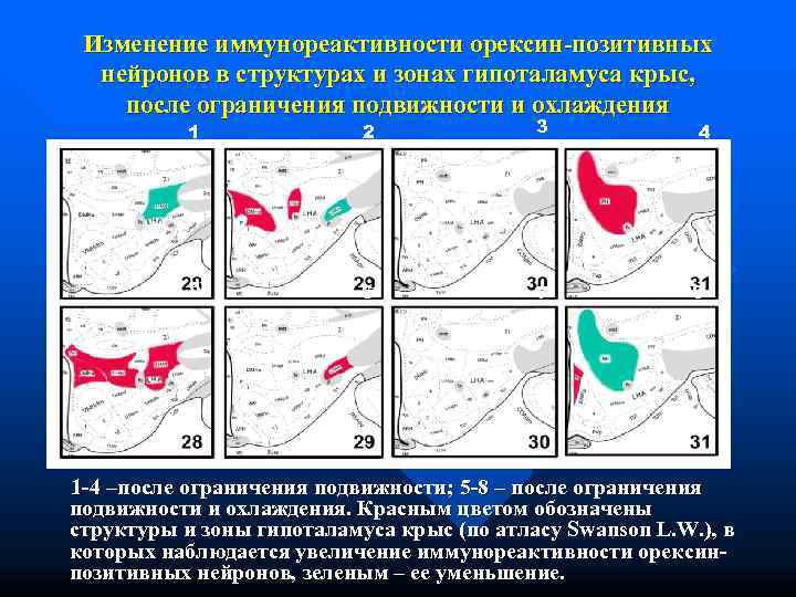  Изменение иммунореактивности орексин-позитивных  нейронов в структурах и зонах гипоталамуса крыс, после ограничения