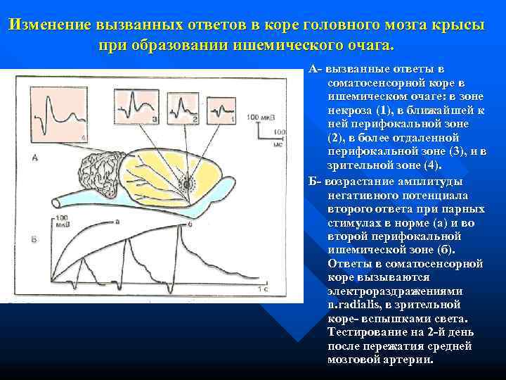 Изменение вызванных ответов в коре головного мозга крысы  при образовании ишемического очага. 