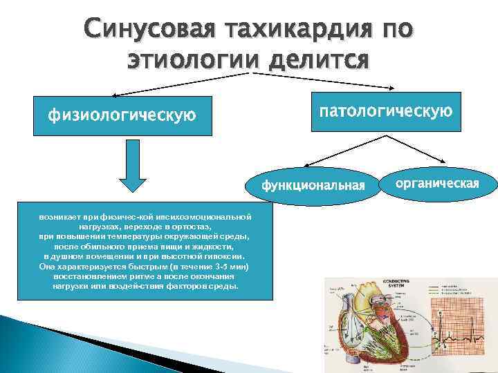    Синусовая тахикардия по   этиологии делится  физиологическую  