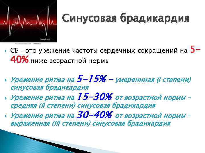    Синусовая брадикардия СБ – это урежение частоты сердечных сокращений на 