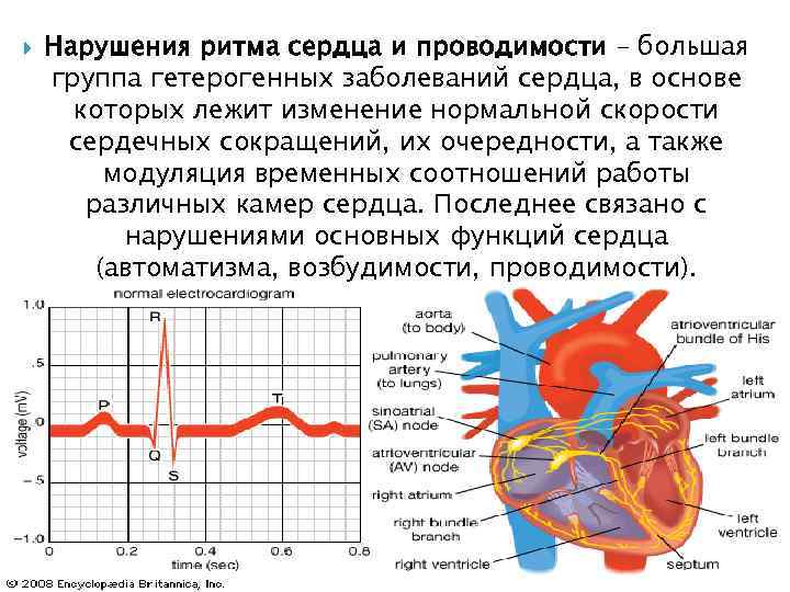   Нарушения ритма сердца и проводимости – большая группа гетерогенных заболеваний сердца, в