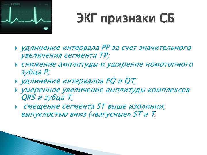    ЭКГ признаки СБ удлинение интервала РР за счет значительного увеличения сегмента