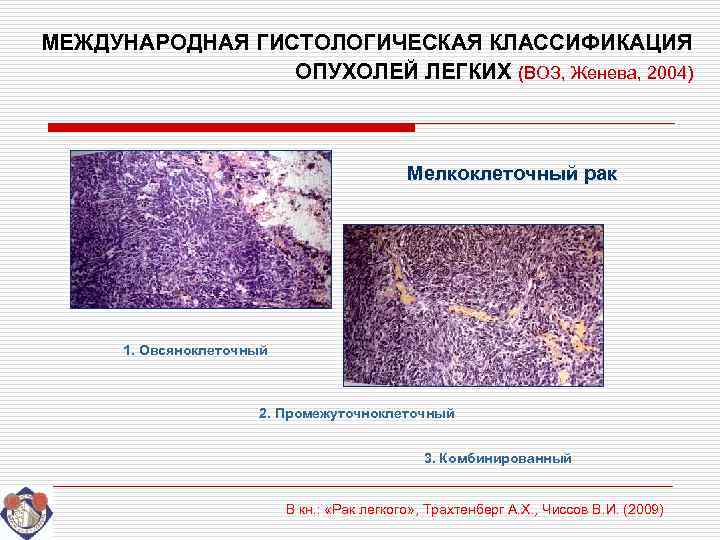 МЕЖДУНАРОДНАЯ ГИСТОЛОГИЧЕСКАЯ КЛАССИФИКАЦИЯ   ОПУХОЛЕЙ ЛЕГКИХ (ВОЗ, Женева, 2004)    