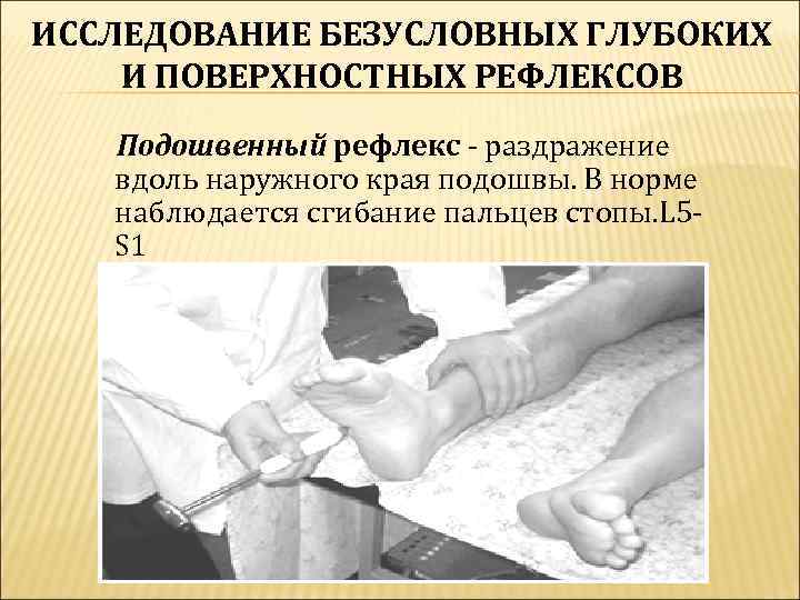 ИССЛЕДОВАНИЕ БЕЗУСЛОВНЫХ ГЛУБОКИХ И ПОВЕРХНОСТНЫХ РЕФЛЕКСОВ  Подошвенный рефлекс - раздражение  вдоль наружного
