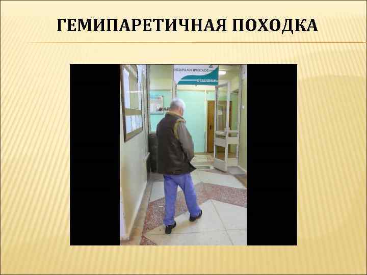 ГЕМИПАРЕТИЧНАЯ ПОХОДКА 