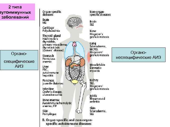   2 типа аутоиммунных заболеваний   Органо-   неспецифические АИЗ специфические