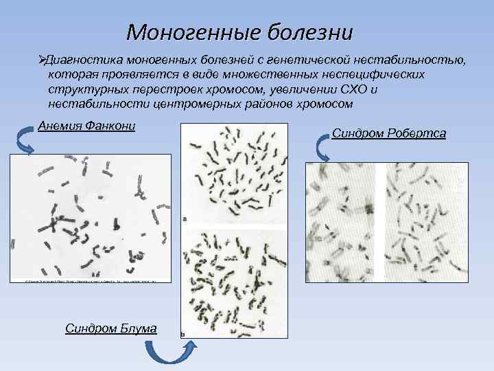    Моногенные болезни ØДиагностика моногенных болезней с генетической нестабильностью,  которая проявляется