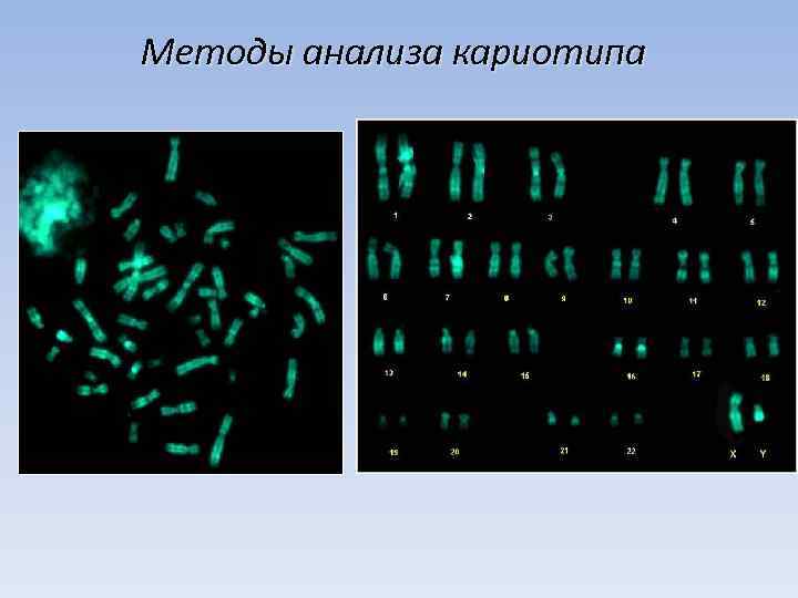 Методы анализа кариотипа 