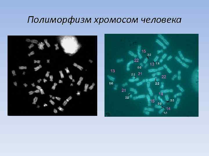 Полиморфизм хромосом человека 