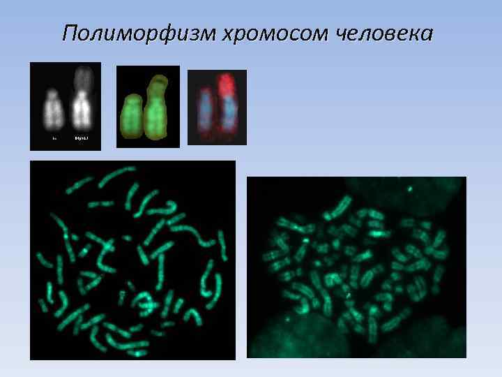 Полиморфизм хромосом человека 