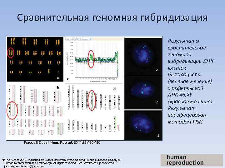  Сравнительная геномная гибридизация        Результаты 