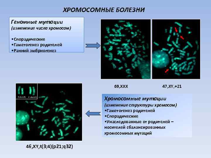      ХРОМОСОМНЫЕ БОЛЕЗНИ Геномные мутации (изменение числа хромосом)  •