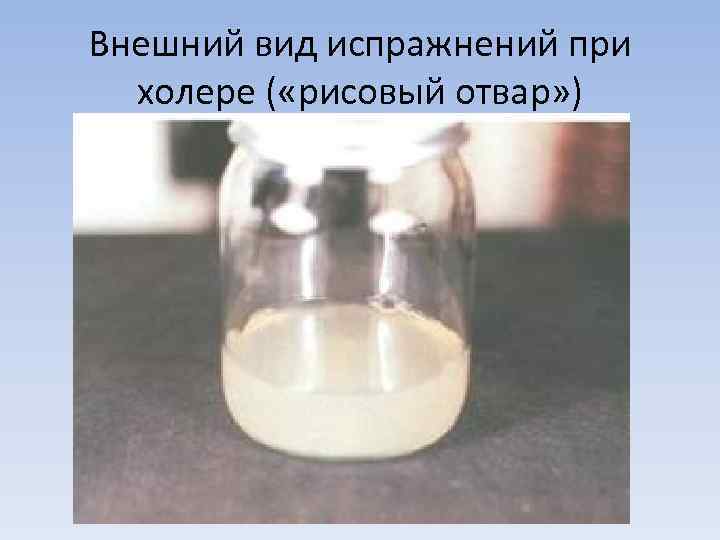 Внешний вид испражнений при  холере ( «рисовый отвар» ) 