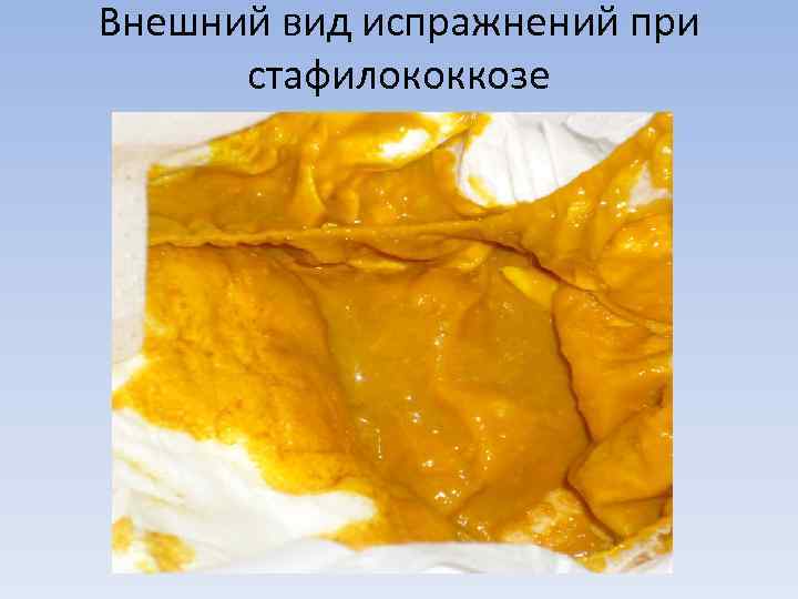 Внешний вид испражнений при  стафилококкозе 