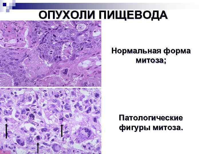 Единичные митозы. Патологические митозы микропрепарат. Патологический митоз. Митоз гистология.