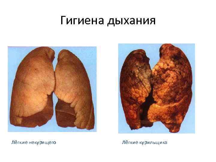 Гигиена дыхания Лёгкие некурящего Лёгкие курильщика Гигиена дыхания Лёгкие некурящего Лёгкие курильщика