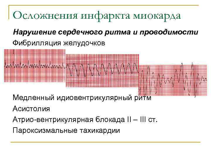 Нарушение сердечного ритма карта вызова скорой медицинской