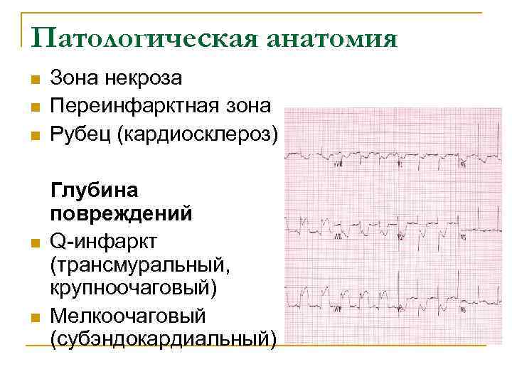 Субэндокардиальная ишемия передней стенки что это