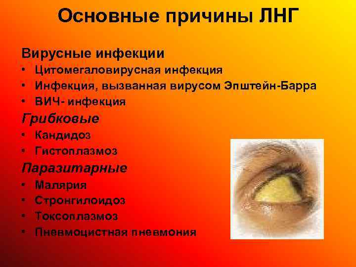   Основные причины ЛНГ Вирусные инфекции • Цитомегаловирусная инфекция • Инфекция, вызванная вирусом