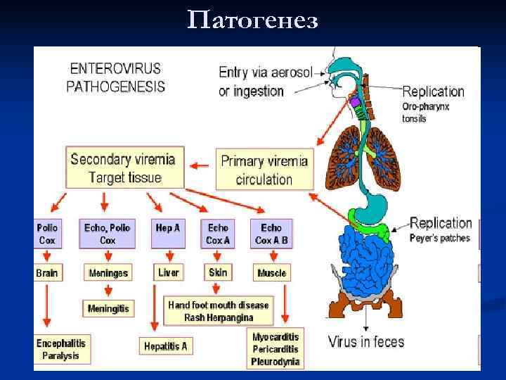 Патогенез 