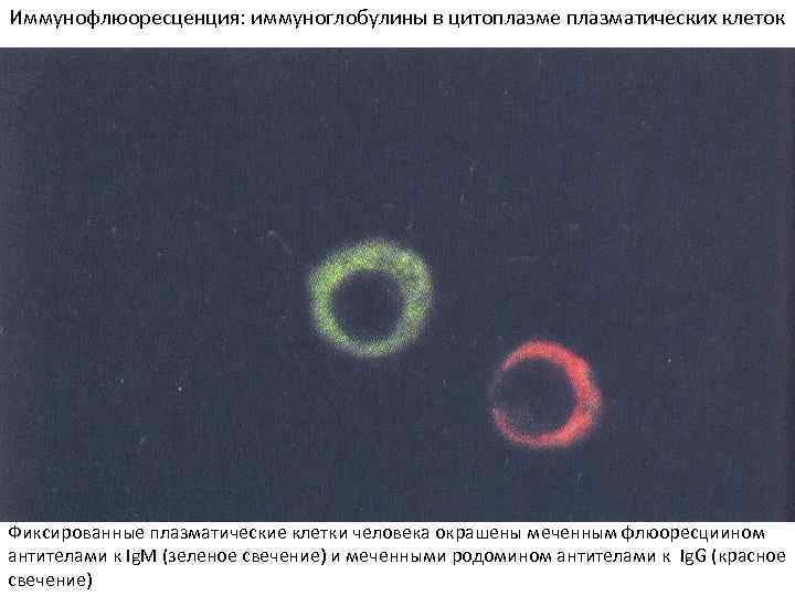 Иммунофлюоресценция: иммуноглобулины в цитоплазме плазматических клеток Фиксированные плазматические клетки человека окрашены меченным флюоресциином антителами
