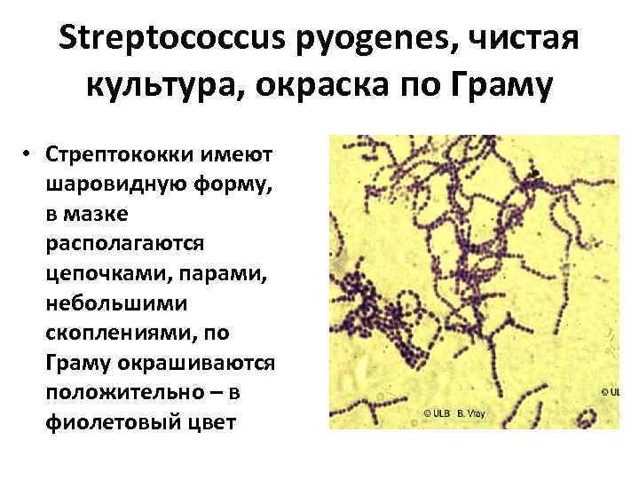  Streptococcus pyogenes, чистая культура, окраска по Граму • Стрептококки имеют  шаровидную форму,