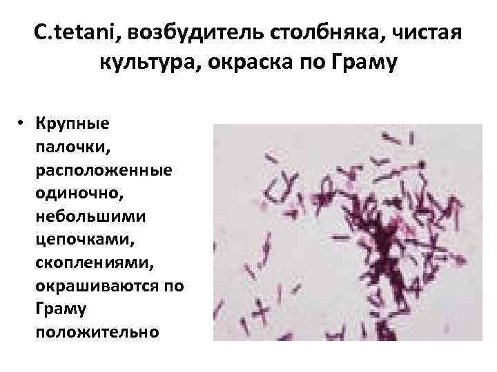  C. tetani, возбудитель столбняка, чистая  культура, окраска по Граму  • Крупные