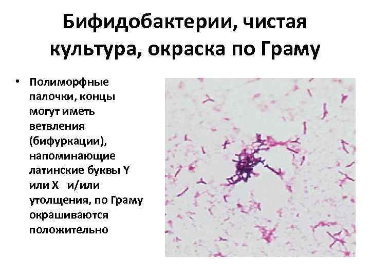  Бифидобактерии, чистая культура, окраска по Граму • Полиморфные  палочки, концы  могут